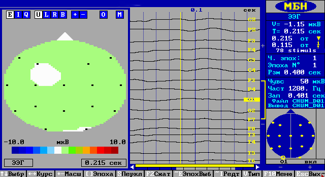 14 лет, пулевое ранение головы с повреждением зрительного нерва правого глаза.