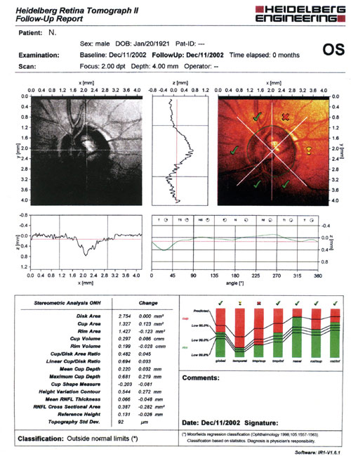 Волков - Рис.2. Регистрация данных Гейдельбергской ретинотомографии