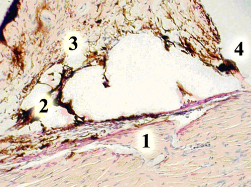 Интактные кролики. Строение угла передней камеры глаза: 1 - шлеммов канал, 2 - корнеомышечная часть трабекулы, 3 - корнеоувеальная часть трабекулы, 4 - гребенчатая связка. Окраска гематоксилином и эозином. Ув.-180