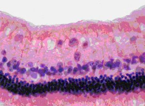 Экспериментальная глаукома. Снижение количества нейронов в ганглиозном слое у кроликов за счет мелких и средних клеток. Окраска гематоксилином и эозином. Ув.  200